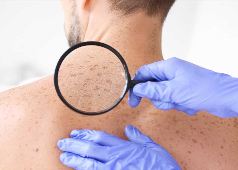 Skin Assessment - Dermatology Services