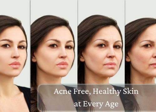 acne treatment for every age