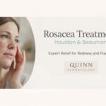 rosacea treatment in Houston and Beaumont