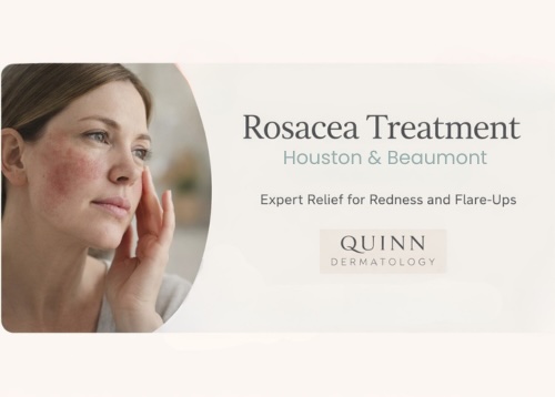 rosacea treatment in Houston and Beaumont