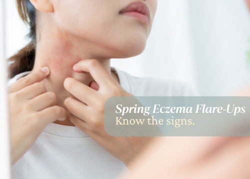 Spring Eczema Flare-Ups